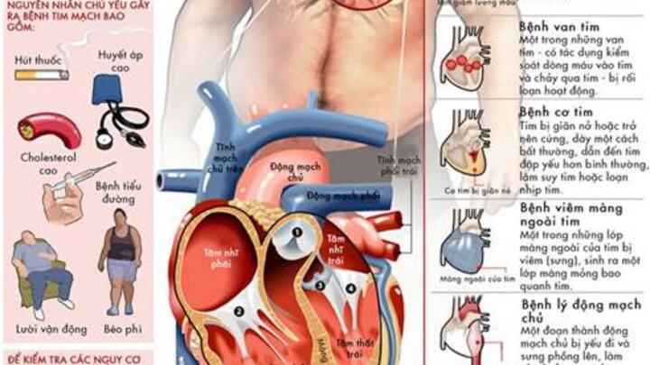 CHỦ ĐỘNG PHÁT HIỆN SỚM BỆNH TIM MẠCH – GIẢI PHÁP BẢO VỆ SỨC KHỎE CỘNG ĐỒNG
