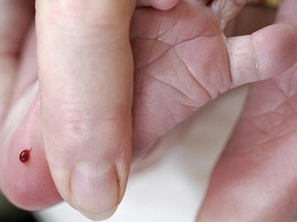 F:\VAN BAN DAN SO\TÀI LIỆU SÀNG LỌC SƠ SINH\Lấy máu gót chân (1).jpg