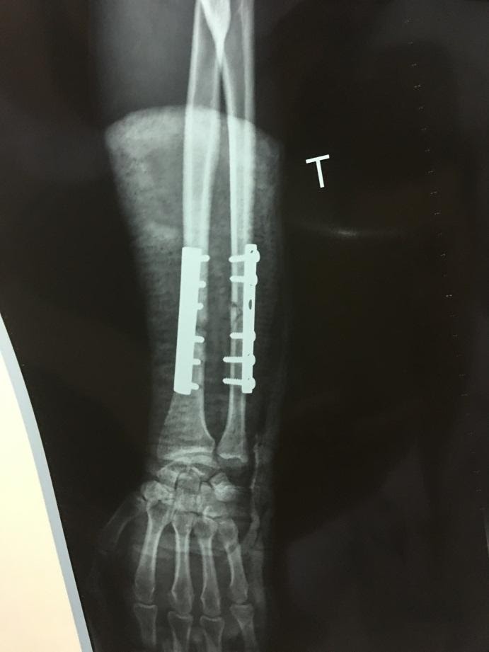 C:\Users\Administrator\AppData\Local\Microsoft\Windows\Temporary Internet Files\Content.Word\IMG_8986.jpg