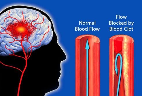 9-bo-phan-co-the-bi-huy-hoai-boi-thuoc-la-6
