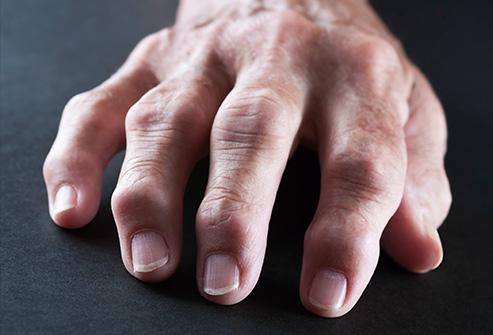 9-bo-phan-co-the-bi-huy-hoai-boi-thuoc-la-1