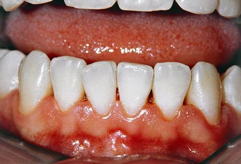 9-bo-phan-co-the-bi-huy-hoai-boi-thuoc-la-5